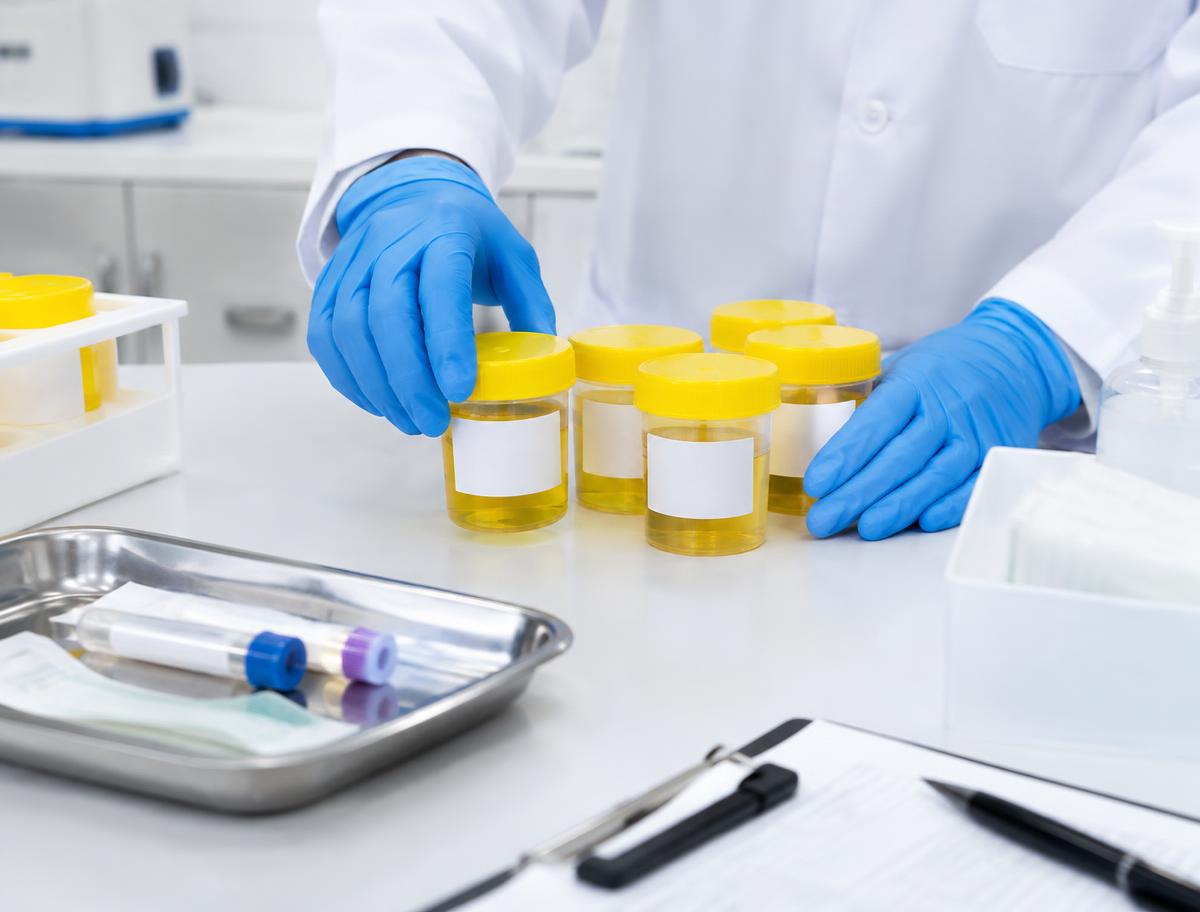 Gloved technician arranging sealed urine specimen collection containers